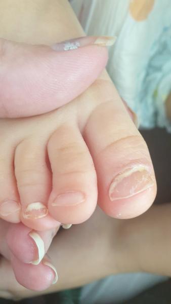 Nehty. O co by se mohlo jednat?