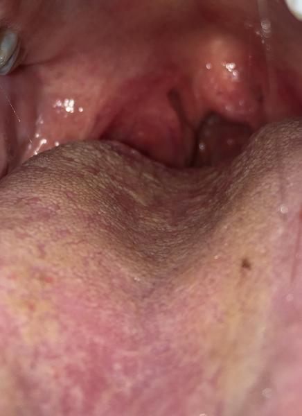 Bolest v krku. Vidíte tam něco?