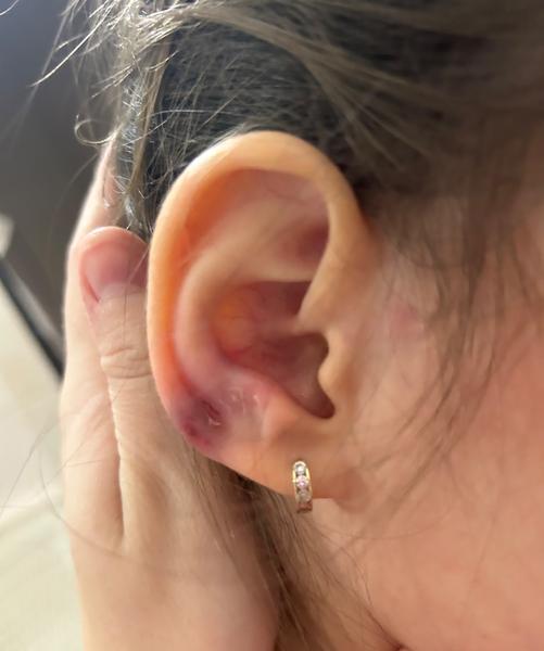 Dítě spadlo a praštilo se o roh: Co dělat?