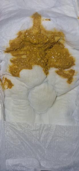 Stolice novorozence na umělé výživě. Je normální?