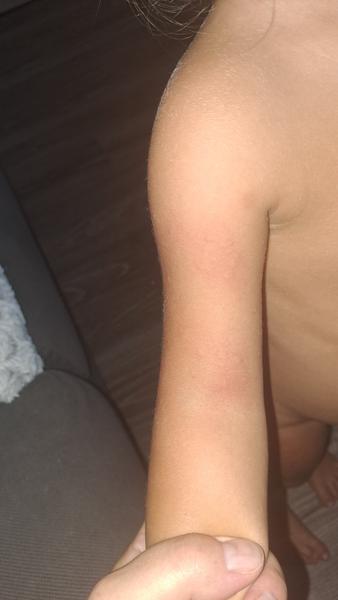 Je to kopřivka nebo něco jiného?