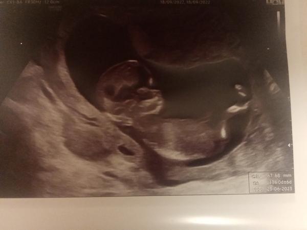 Pohlaví. Poznáte z fotky?