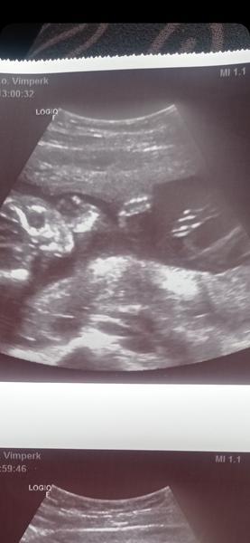 Pozná se ve 21. týdnu pohlaví dítěte?