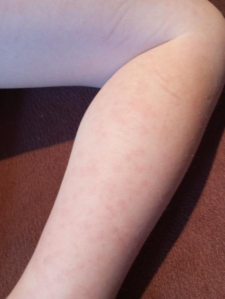 Je to pátá, šestá nebo sedmá nemoc u dětí?