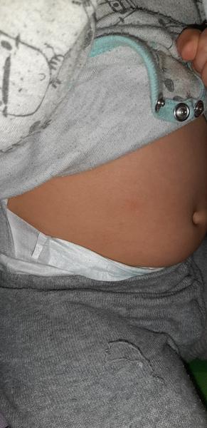 Osypané miminko. Je normální, že to má už 5 dní nebo je to něčím jiným?