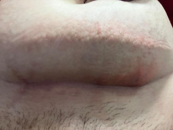 Názory na bolestivou bulku u kamarádky: Co to je?