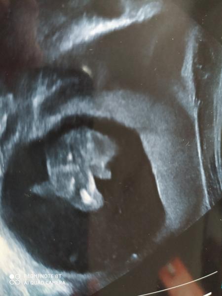 Pohlaví. Holka nebo kluk?