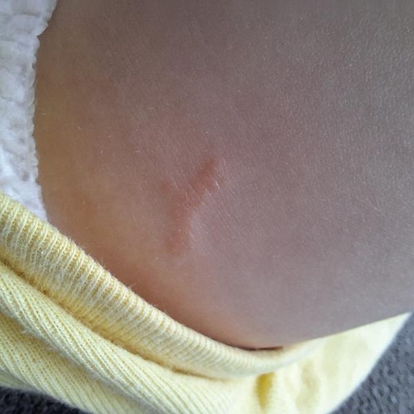 Co má syn na noze a proč se to zvětšuje?