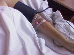 Endometrióza - operační vyšetření