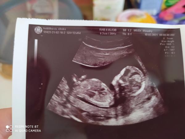 Pohlaví. Co myslíte vy?