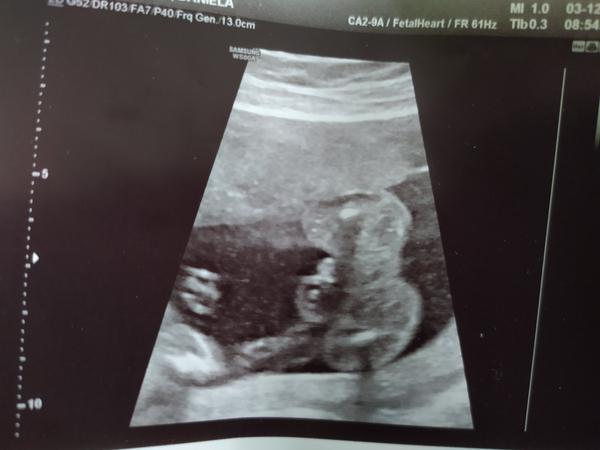 Chlapeček. Ukážete mi, kde je na fotce pohlaví?