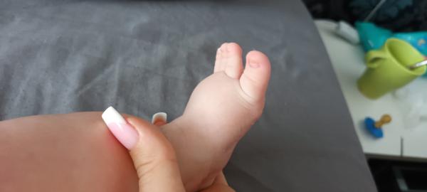 Co způsobuje otok nožiček u čtyřměsíčního syna?