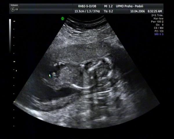 Co si myslíte, že je to za pohlaví?