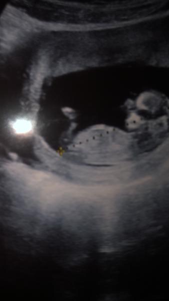 Je to podle ultrazvuku holka nebo kluk?