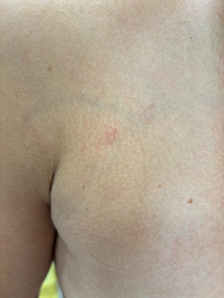 Co způsobuje svědivé vyrážky na těle? Zjistěte více!