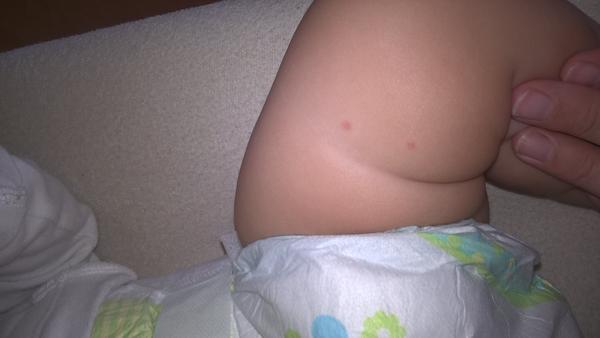 8měsíční mimi má červené flíčky