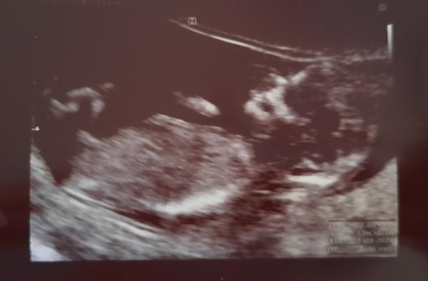 Holčička nebo chlapeček?