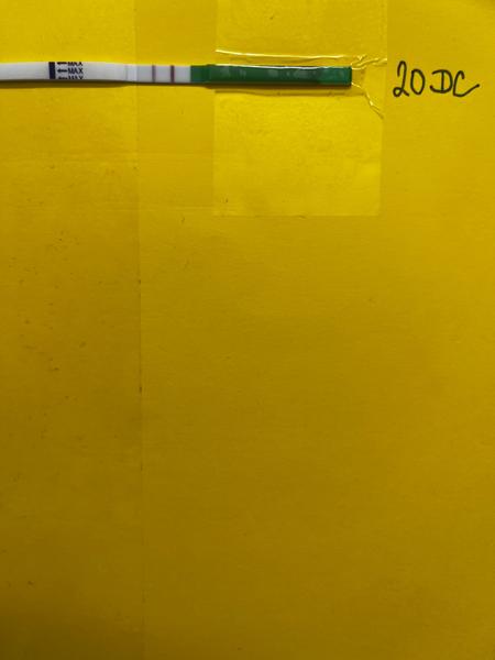 Může PCOS ovlivnit přirozenou ovulaci po drillingu?