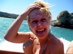 Akné - nadměrné slunění