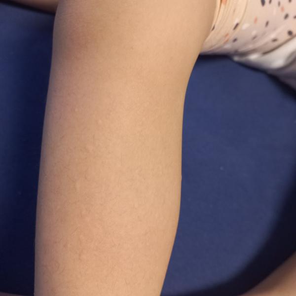 Příznaky alergie: Jak poznat skutečný problém?