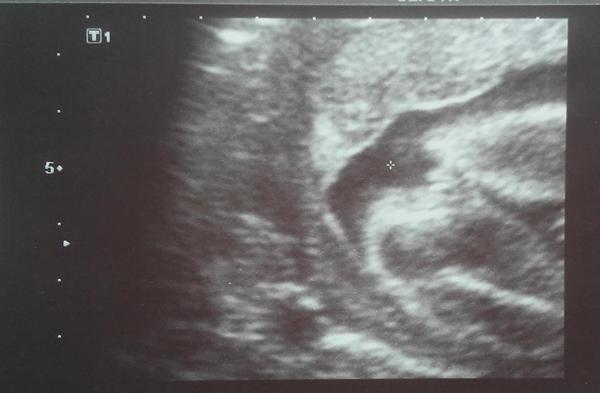 Holčička nebo chlapeček? Co vidíte?