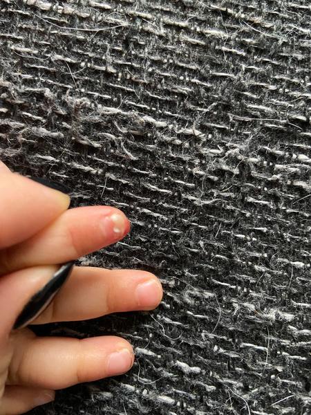 Strhnutý nehet u dítěte: Nechat být nebo ustřihnout?