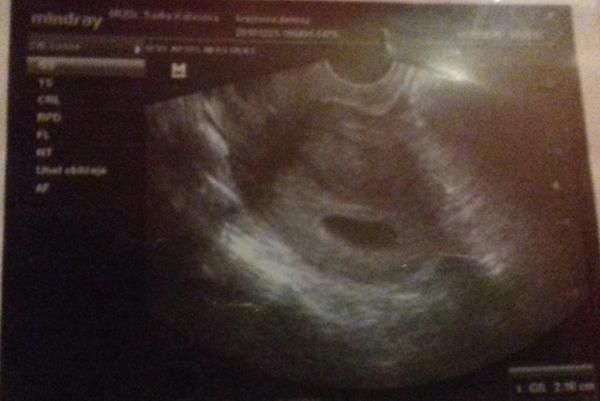 Druhé miminko - srpen 2019 😊