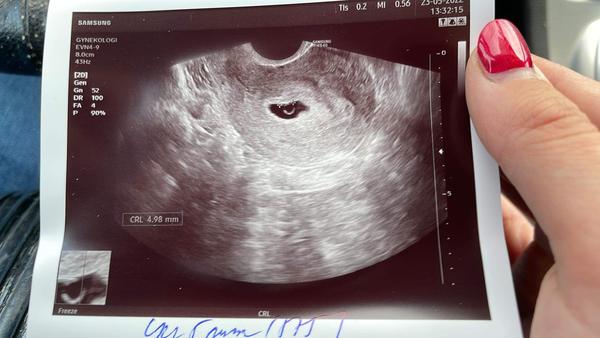 Opožděná ovulace a rozdíl ve stáří těhotenství. Máte zkušenost?