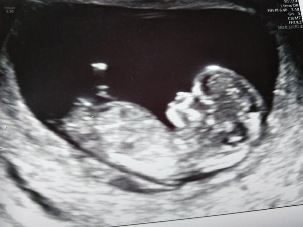 Pohlaví. Troufla by si některá na odhad?