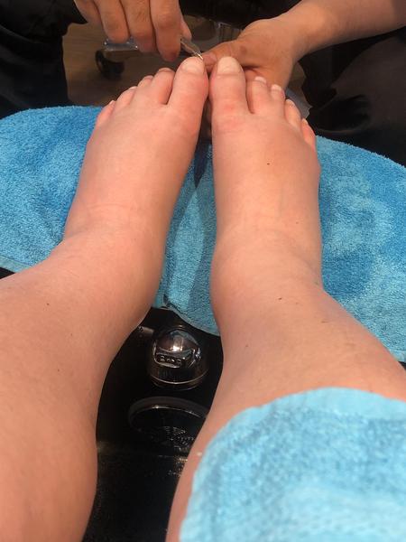 Jak řešit otoky nohou ve 24. týdnu těhotenství?