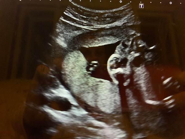 Fotka UTZ. Vidíte tu holku?🙂