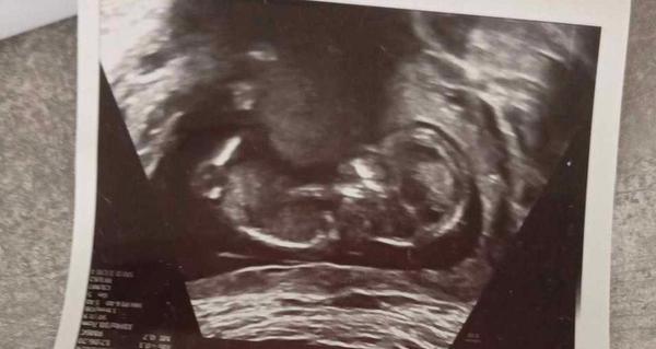 Jak odhadnout pohlaví dítěte před potvrzením lékařem?