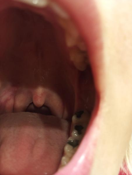 Kdy navštívit lékaře při bolesti v krku?