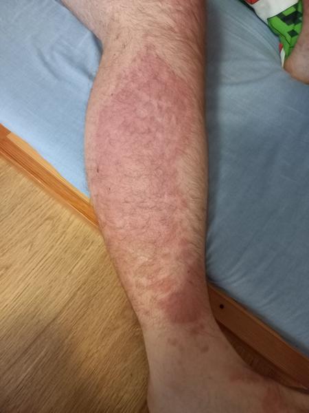 Kdy vyhledat lékařskou pohotovost? Zjištění příznaků nemoci u manžela.