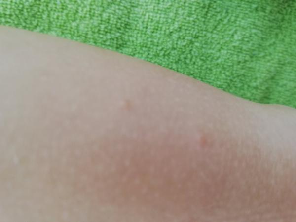 Je to prosím moluska?