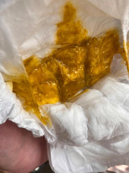 Může změna stolice a neklid u kojence znamenat reflux?