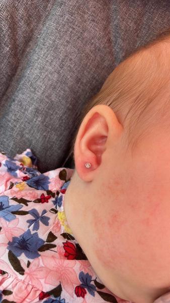 Co dělat s náušnicemi nastřelenými příliš vysoko?