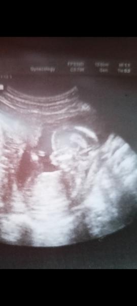 Určení pohlaví. Lze z tohoto snímku poznat?