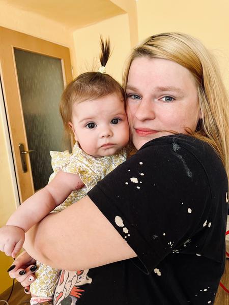 Je pocení na hlavičce u dětí normální nebo problém?