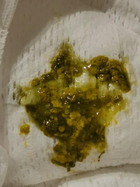 Hlen ve stolici + teplota 37,3 °C. Poradíte, prosím?