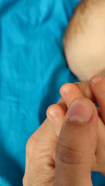 Rýhy na nehtech u ročního dítěte: Příčiny a řešení?