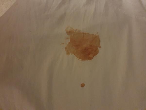 Mlezivo/kolostrum v těhotenství. Máte zkušenosti ohledně zbarvení?