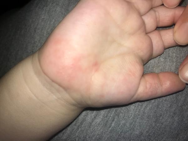 Syn má parainfekční virózu. Z čeho by to mohlo být?