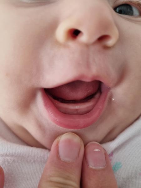 Jak poznat růst zoubků u tříměsíční dcery?