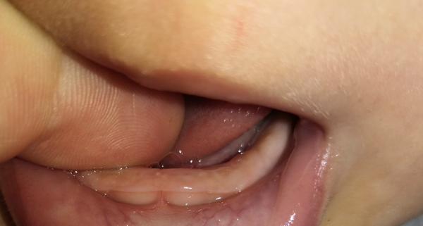 Jsou neklid a slintání u šestiměsíčního dítěte známkou zoubků?