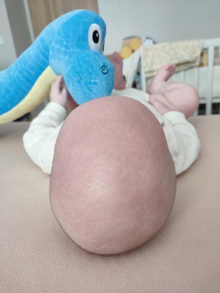 Zkušenosti se srovnáním křivé hlavičky bez helmičky?