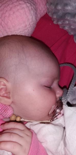 Mohou to být petechie?