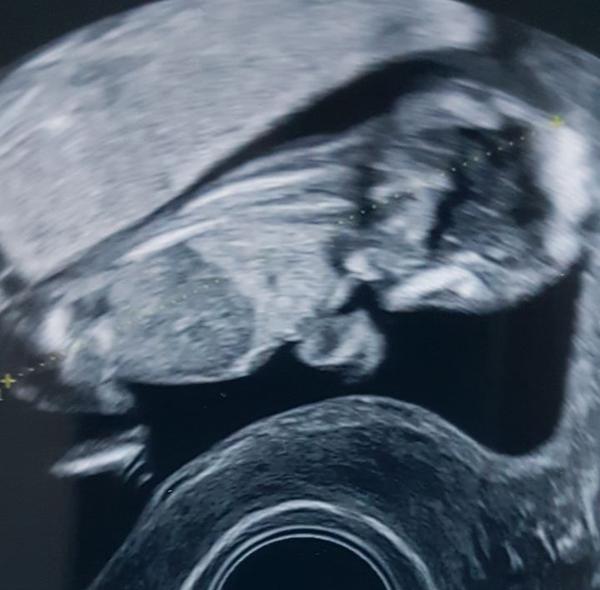 Pohlaví podle utz. Poznáte?