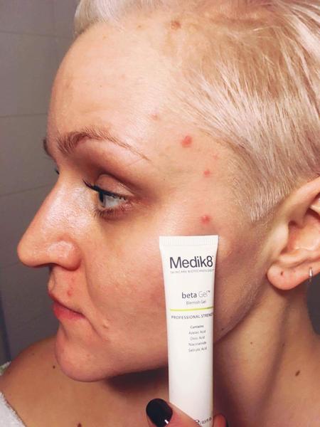 SOUTĚŽ: Jaké problémy vás trápí