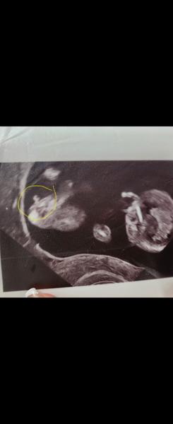 Pohlaví. Co byste řekly?